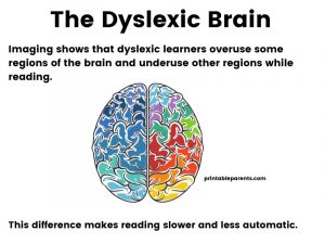 The Brain and Reading - Printable Parents